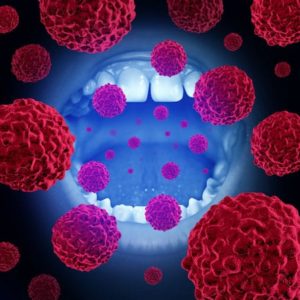 illustration of mouth with cancer cells