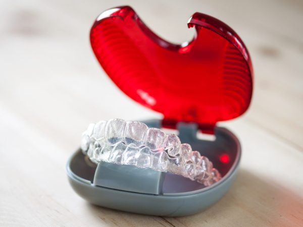 photo of invisalign